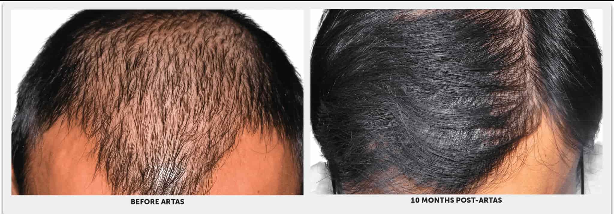Before and After Hair Image