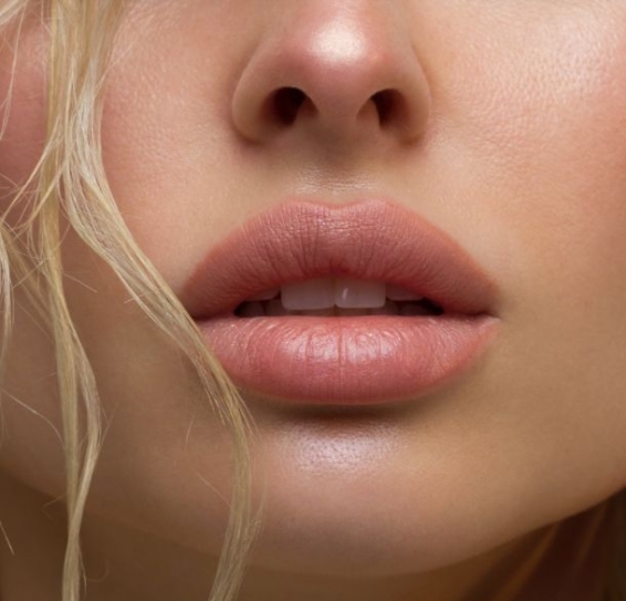 Dermal Fillers