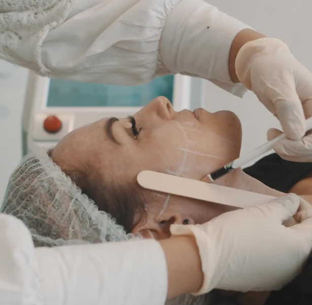 Ultracel Treatment