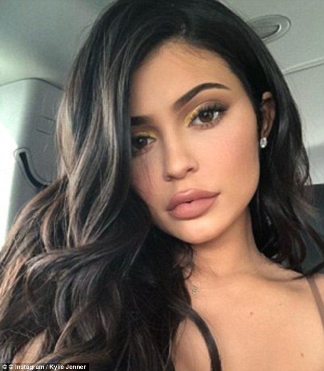Kylie Jenner with her plumped-up pout. The beauty guru and Instagram influencer recently revealed she had decided to have her fillers removed shortly after becoming a mother