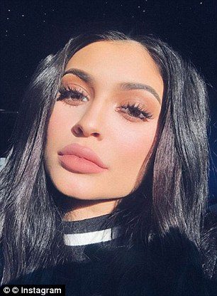 Kylie Jenner was known for her plumped-up pout