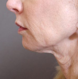 Exercises to prevent jowls hot sale