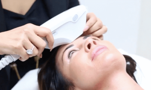 Ultherapy: The Skin Lifting Treatment in Prestbury