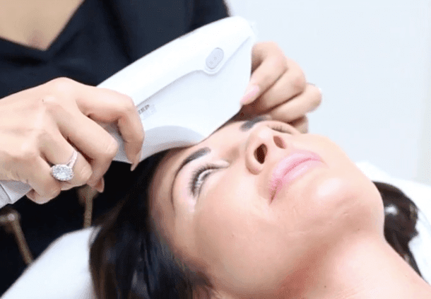 Ultherapy: The Skin Lifting Treatment in Prestbury