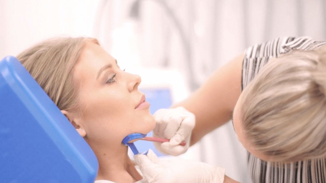 CoolSculpting your Double Chin