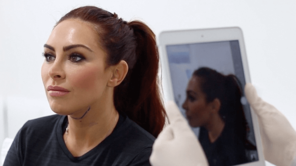 waiting-for-coolsculpting-treatment-consultation