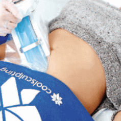 The CoolSculpting fat-freezing procedure in Dr Nyla clinic
