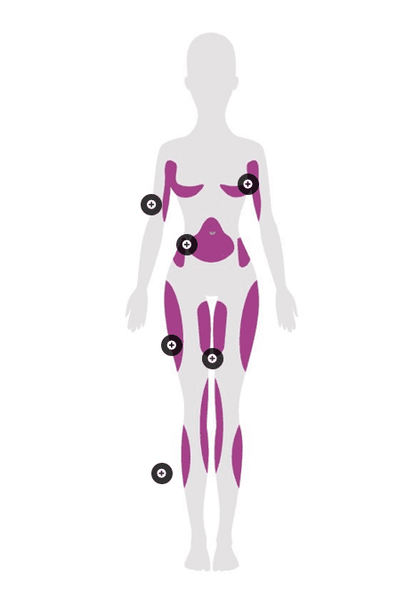 lipocel-treatment-areas
