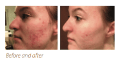 pro-facial-before-and-after