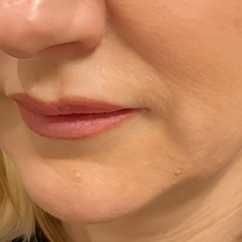 ultracel intracel b2