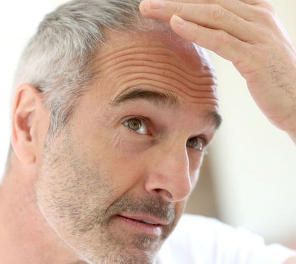 What is an FUE Hair Transplant? - Doctor Nyla Medispa