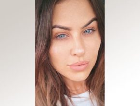 What *not* to do after lip fillers