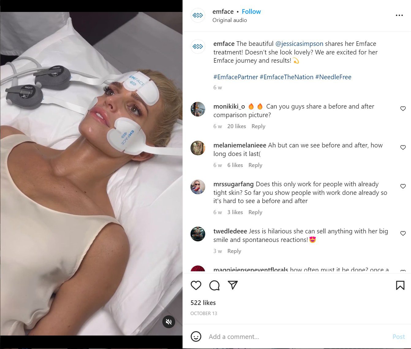 jessica simpson emface