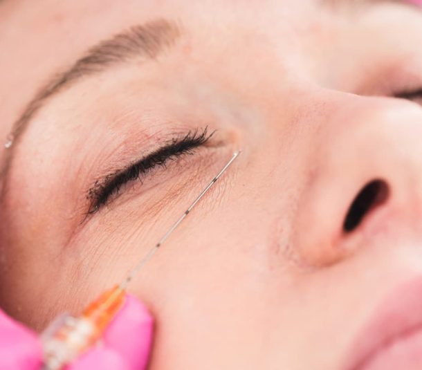 What Are the Benefits of Dermal Eye Fillers? | A Treatment Guide