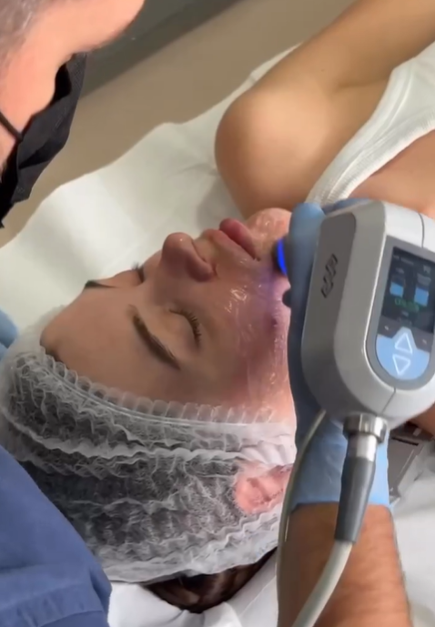 Exilis Elite Face