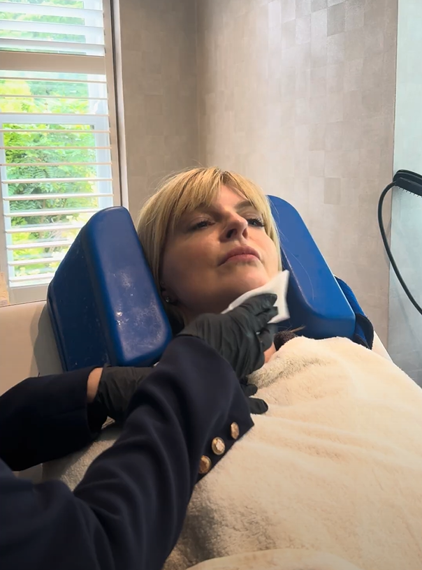 CoolSculpting Preparation