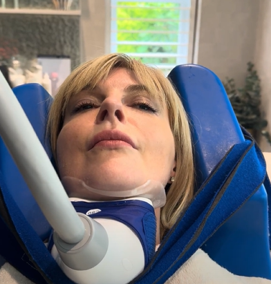 CoolSculpting on Chin