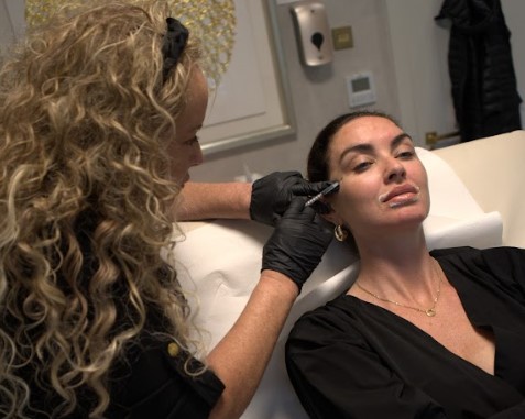 Dermal Filler Treatment