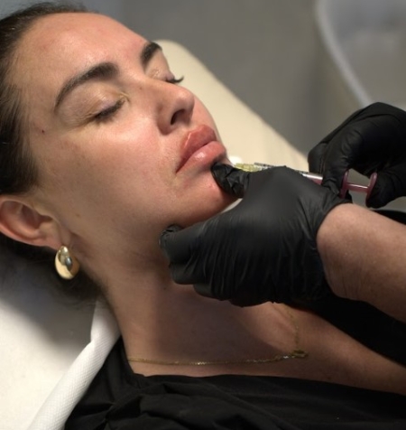 Dermal Filler