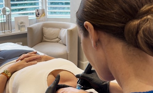 Hydrafacial InTreatment