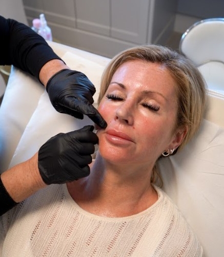 Profhilo Anti-Aging Treatment