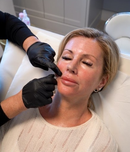Profhilo Anti-Aging Treatment