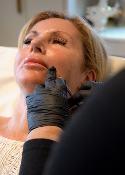 Profhilo Treatment