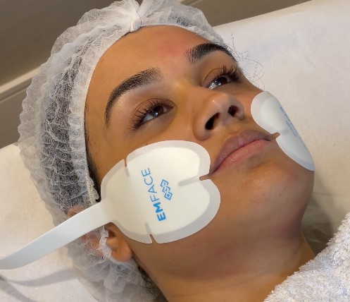 Emface Treatment in London