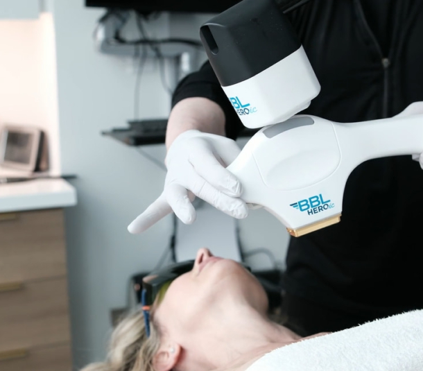 BBL HEROic Laser Treatment Video Thumbnail