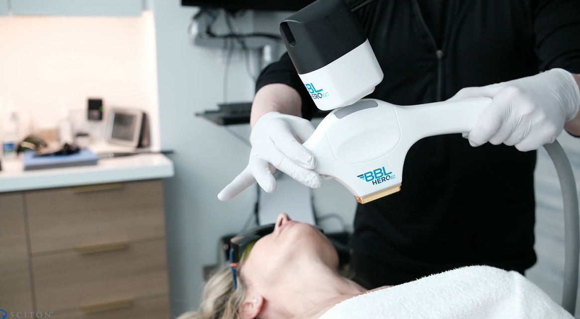 BBL HEROic Laser Treatment Video Thumbnail