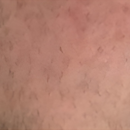 Body-Acne-Treatment-After