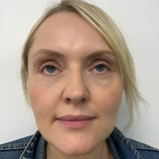 Polynucleotide Treatment for Under Eyes Before