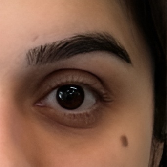 Polynucleotides for Under Eyes Before