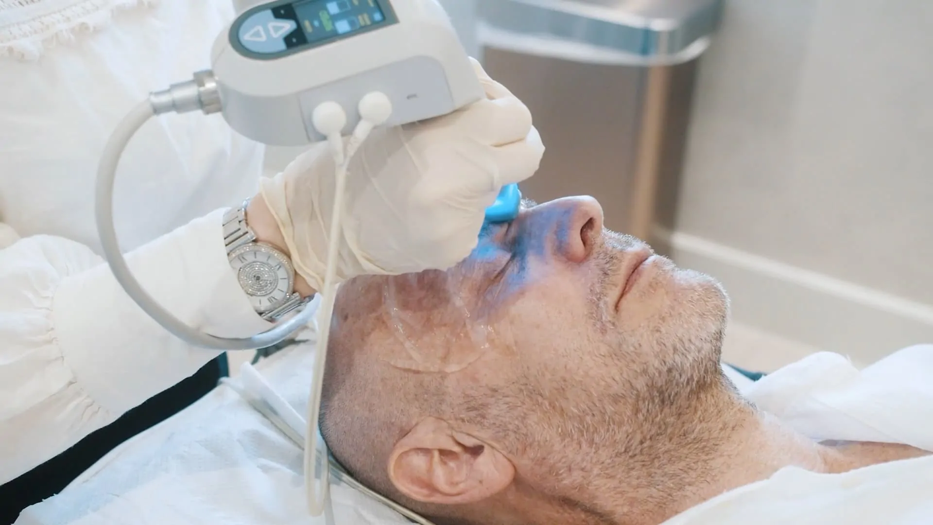 Exilis Elite Treatment on Man Face