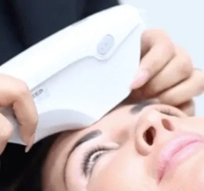 INTRAcel treatment on face