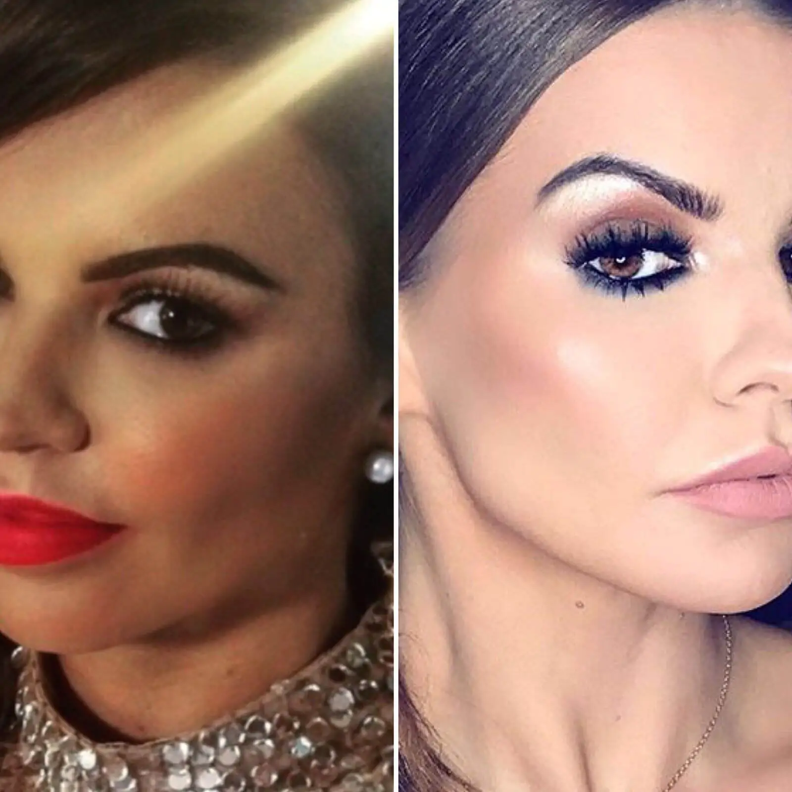Tanya Bardsley Before & After Ultracel