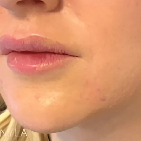 ultracel intracel a2