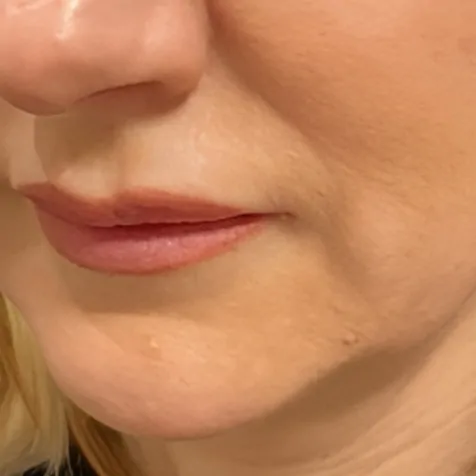 ultracel intracel b2