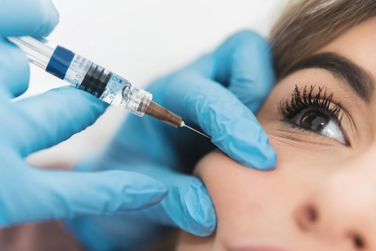 Injector administering tear trough filler beneath the eye to smooth under-eye hollows and improve dark circles.