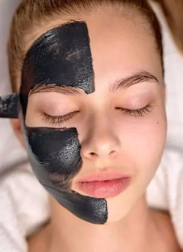 Carbon Peel Mask