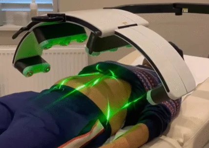 Emerald Laser Treatment