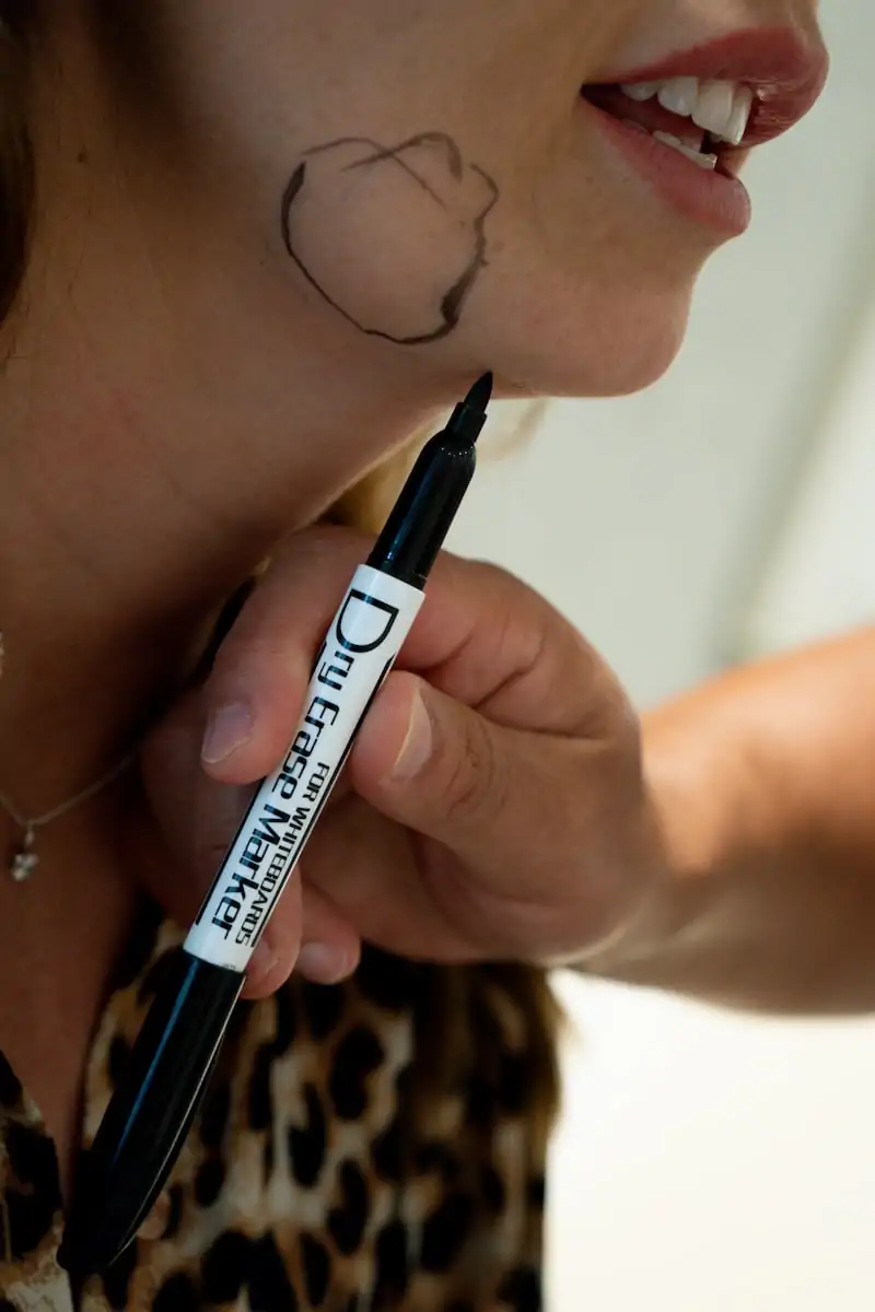 Aqualyx Fat Dissolving Consultation