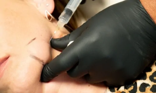 Aqualyx Fat Dissolving Treatment