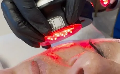 Hydrafacial Red Light Therapy