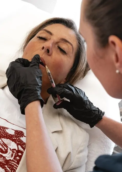 Lip Filler Treatment