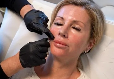 Profhilo Anti-Aging Treatment