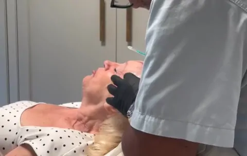 Exosomes Treatment for Scarring