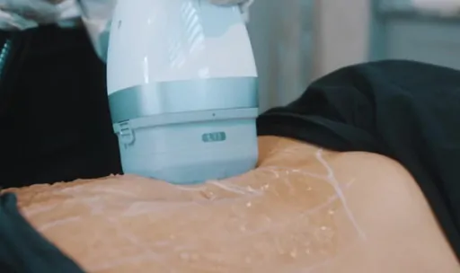 LipoCEL Mummy Makeover