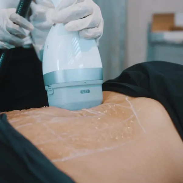 LipoCEL Mummy Makeover