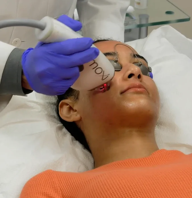 Moxi facial treatment performed on patient